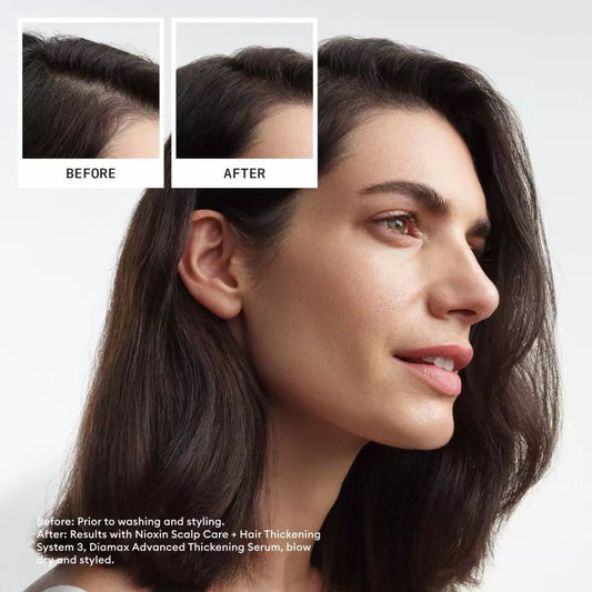 Nioxin Professional System 3 Kit For thining hair - Salonmarjoahola - Shop