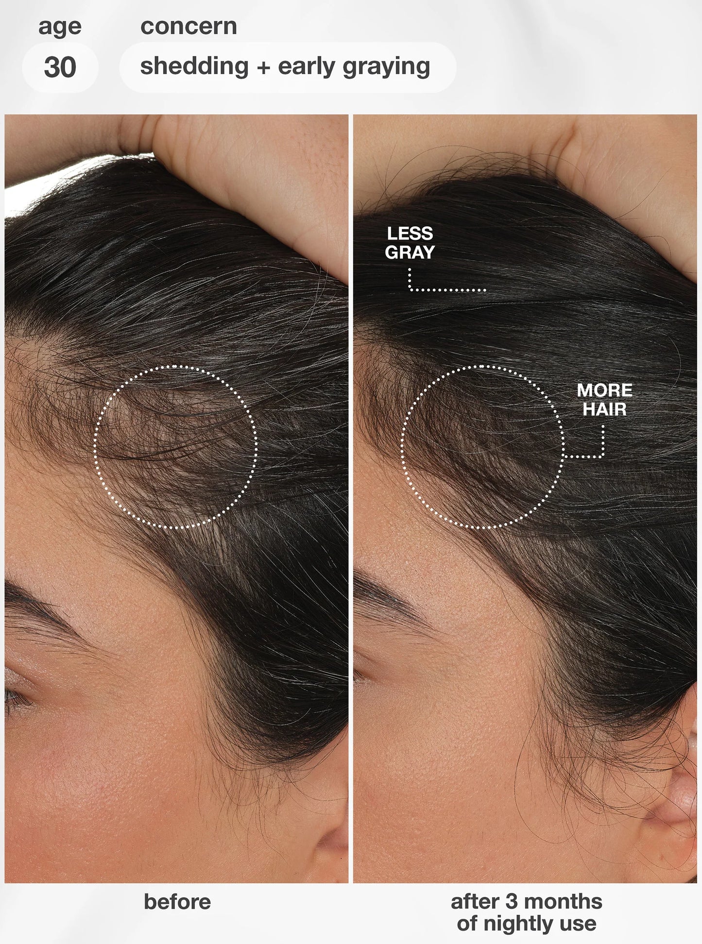 K18 FutureIQ Biomimetic Hair Longevity seerumi 90ml