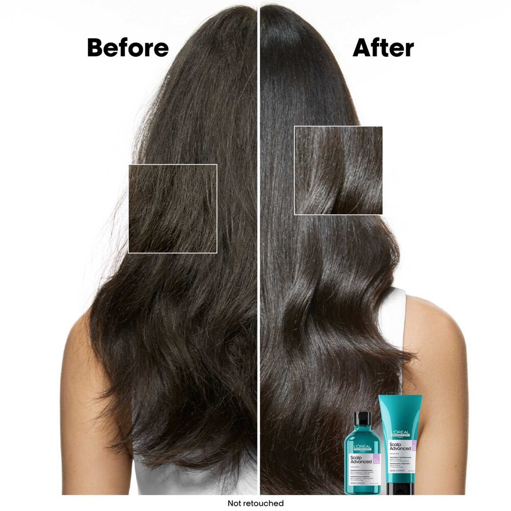 Loreal Scalp Advanced Anti - Discomfort Shampoo 500 ml - Salonmarjoahola - Shop