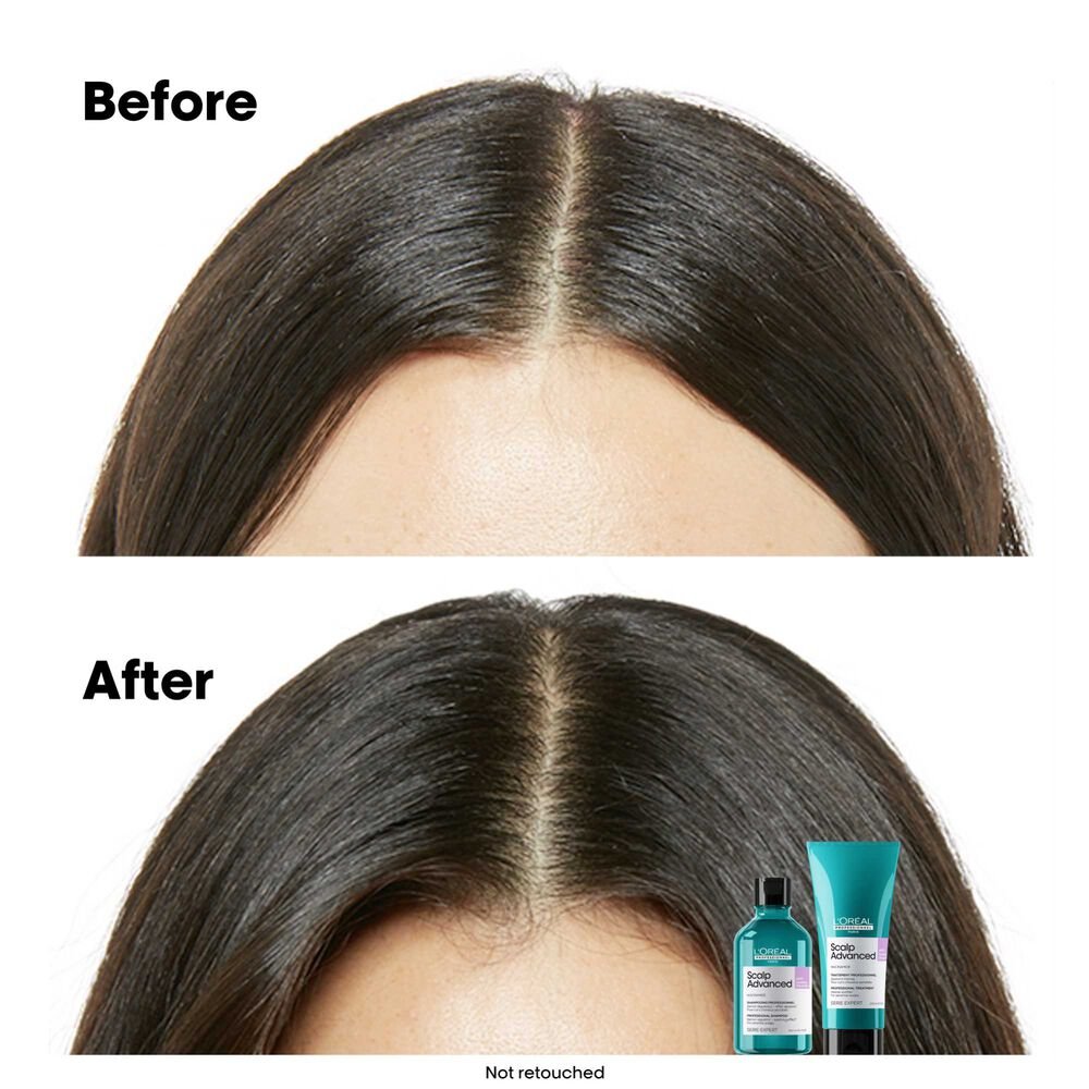 Loreal Scalp Advanced Anti - Discomfort Shampoo 500 ml - Salonmarjoahola - Shop