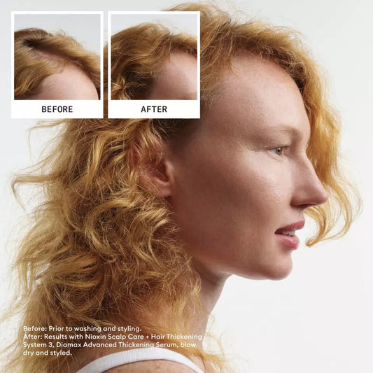 Nioxin Professional System 4 Kit For thining hair - Salonmarjoahola - Shop